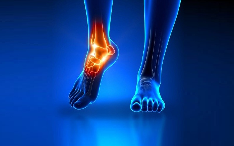 علائم خطرناک درد مچ دست و پا چیست؟