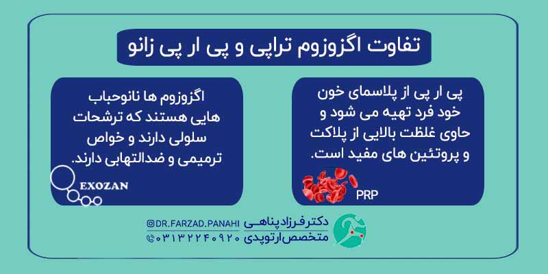 تفاوت اگزوزوم تراپی و پی ار پی زانو