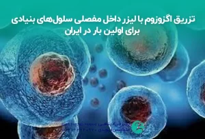 تزریق اگزوزوم با لیزر داخل مفصلی سلول_های بنیادی