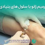 ترمیم زانو با سلول های بنیادی