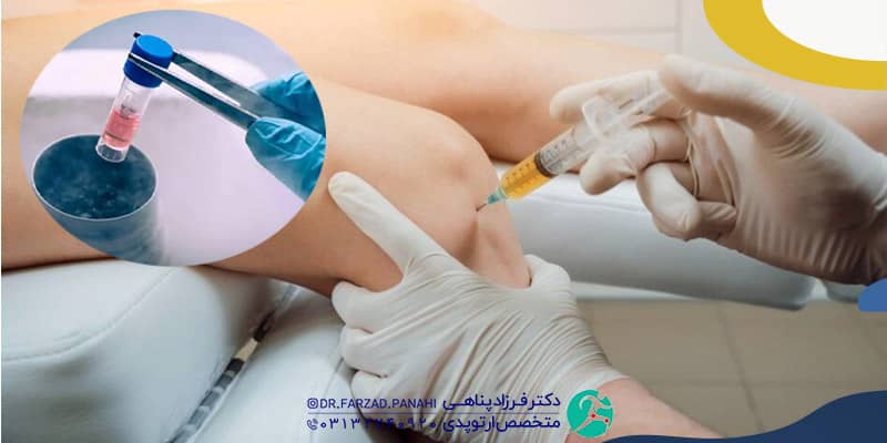 چگونگی درمان آرتروز با سلول های بنیادی