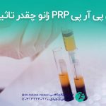 تزریق پی آر پی PRP زانو چقدر تاثیر دارد