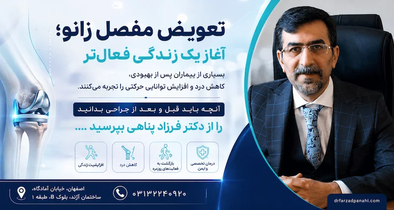تجربه بیماران بعد از تعویض مفصل زانو