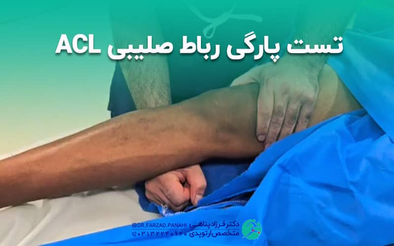 تست پارگی رباط صلیبی