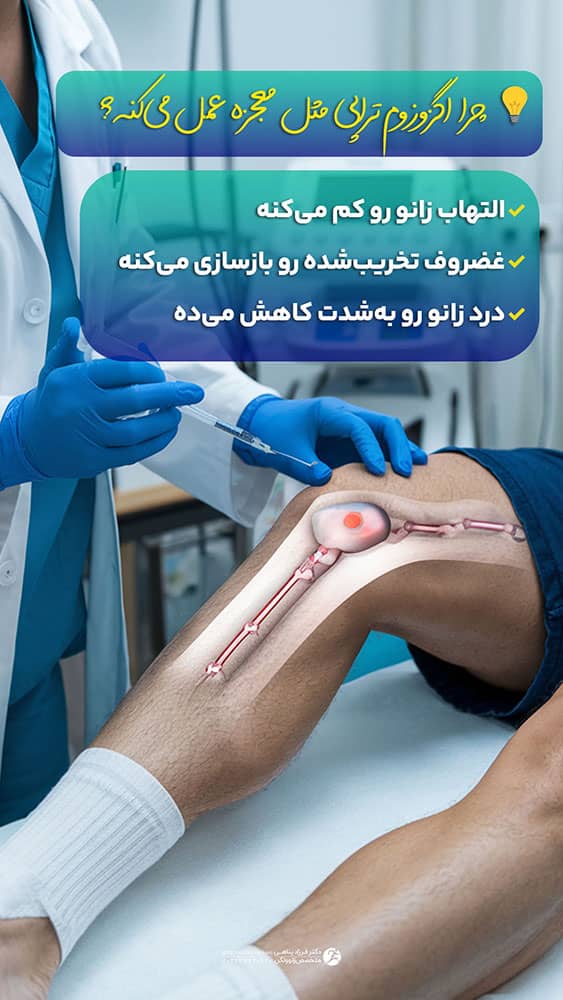 درمان درد زانو با اگزوزوم