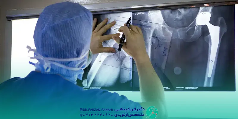 دکتر خوب جراحی لگن