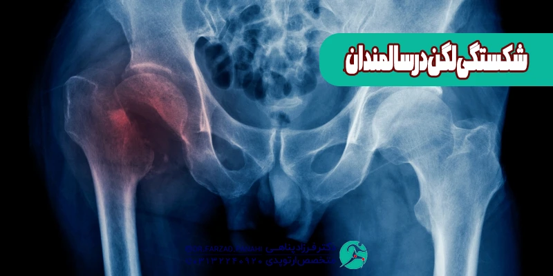 شکستن لگن در سالمندان